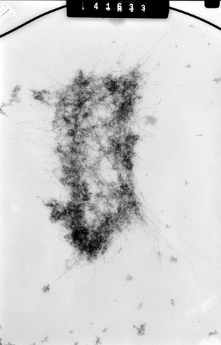 CIL:40690, Mus musculus, fibroblast