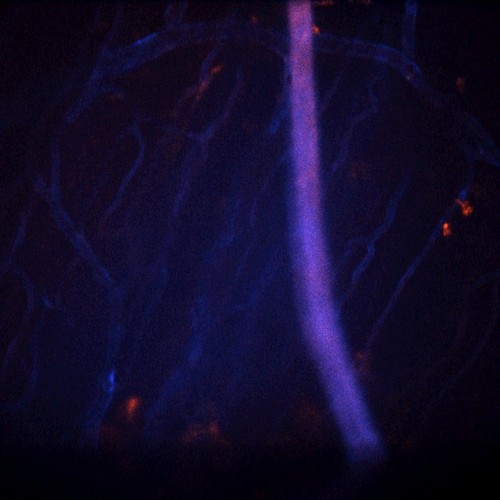 CIL:47651, Staphylococcus aureus, neutrophil, endothelial cell