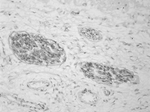 CIL:33541, Homo sapiens, endocrine-paracrine cell of prostate gland, basal cell of prostate epithelium, luminal cell of prostate epithelium, blood vessel endothelial cell, perineural cell, sheath cell, leukocyte, prostate stromal cell, smooth muscle cell of prostate