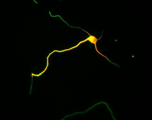 CIL:8272, Rattus, multipolar neuron