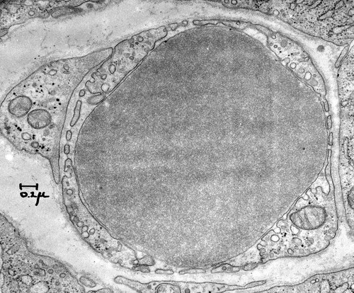 CIL:37132, Coloceras guinea, blood cell, capillary endothelial cell, pericyte cell