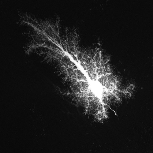 CIL:36369, Rattus norvegicus, astrocyte, astrocyte of the hippocampus