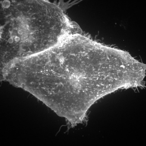 CIL:9098, Homo sapiens, permanent cell line cell, epithelial cell