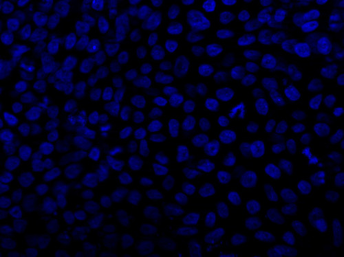 CIL: 54767, Homo sapiens, SBAD2 human iPSC line