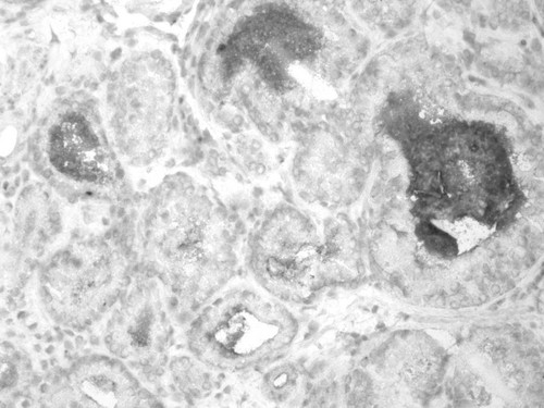 CIL:32246, Homo sapiens, endocrine-paracrine cell of prostate gland, basal cell of prostate epithelium, luminal cell of prostate epithelium, blood vessel endothelial cell, perineural cell, sheath cell, leukocyte, prostate stromal cell, smooth muscle cell of prostate