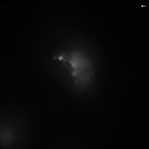 CIL:9186, Homo sapiens, permanent cell line cell, epithelial cell