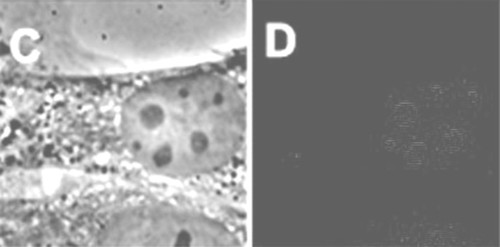 CIL:25112, Mus musculus, fibroblast