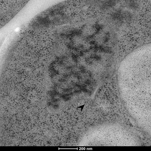 CIL: 50866, Saccharomyces cerevisiae (baker's yeast, budding yeast), Mixed population of S. cerevisiae cells