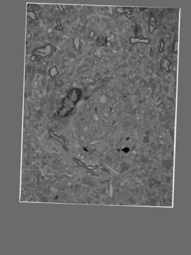 CIL:40182, Homo sapiens, pyramidal cell, neuron of cerebral cortex