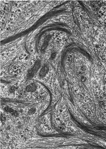 CIL:36068, Spermophilus citellus, Sertoli cell