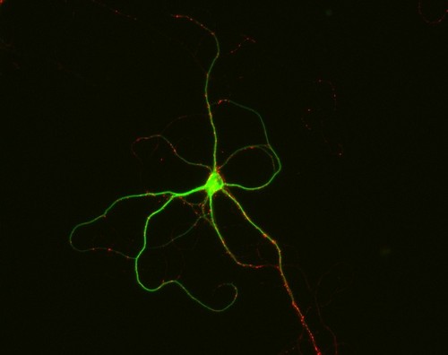 CIL:12553, Rattus, multipolar neuron