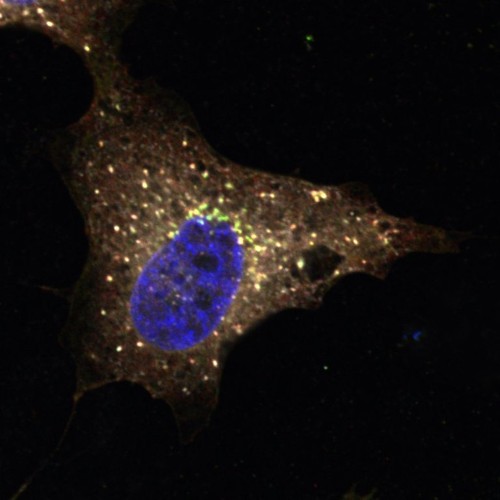 CIL:13568, Homo sapiens, epithelial cell, cervical carcinoma