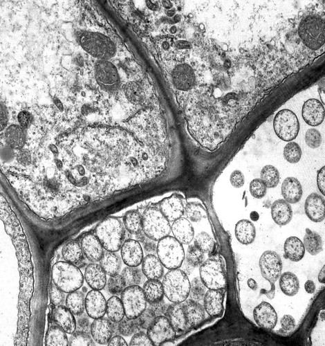 CIL:12578, Spiroplasma kunkelii, Zea mays, plant cell, prokaryotic cell