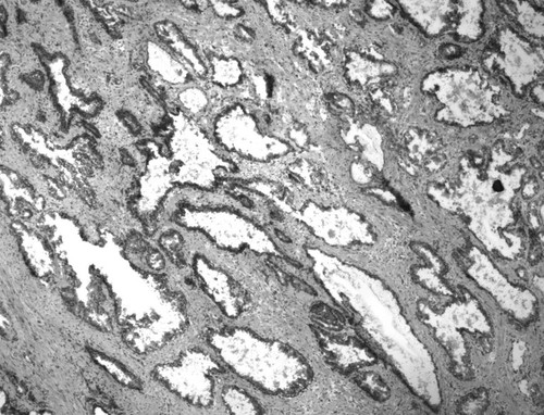 CIL:33659, Homo sapiens, endocrine-paracrine cell of prostate gland, basal cell of prostate epithelium, luminal cell of prostate epithelium, blood vessel endothelial cell, perineural cell, sheath cell, leukocyte, prostate stromal cell, smooth muscle cell of prostate