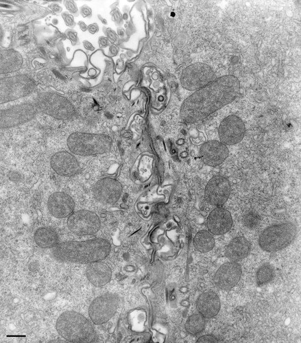 CIL:36656, Paramecium multimicronucleatum, cell by organism, eukaryotic cell, Eukaryotic Protist, Ciliated Protist