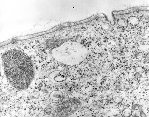 CIL:39324, Vorticella convallaria, cell by organism, eukaryotic cell, Eukaryotic Protist, Ciliated Protist