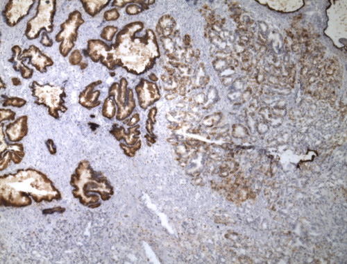 CIL:33125, Homo sapiens, endocrine-paracrine cell of prostate gland, basal cell of prostate epithelium, luminal cell of prostate epithelium, blood vessel endothelial cell, perineural cell, sheath cell, leukocyte, prostate stromal cell, smooth muscle cell of prostate