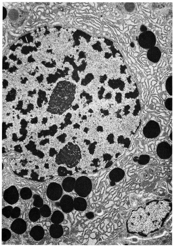 CIL:10970, Rhipicephalus appendiculatus, acinar cell of salivary gland