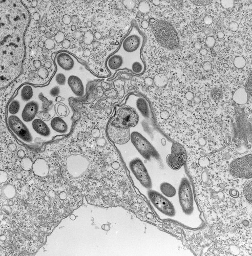 CIL:39504, Vorticella convallaria, cell by organism, eukaryotic cell, Eukaryotic Protist, Ciliated Protist