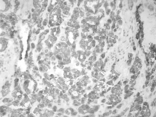 CIL:34235, Homo sapiens, endocrine-paracrine cell of prostate gland, basal cell of prostate epithelium, luminal cell of prostate epithelium, blood vessel endothelial cell, perineural cell, sheath cell, leukocyte, prostate stromal cell, smooth muscle cell of prostate