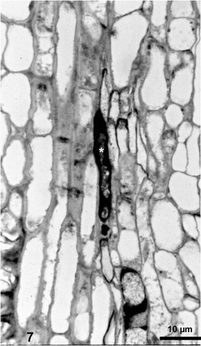 CIL:19129, Spiroplasma kunkelii, Zea mays, plant cell, prokaryotic cell