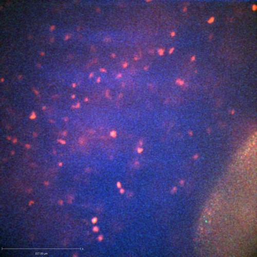 CIL:47315, Staphylococcus aureus, neutrophil, endothelial cell