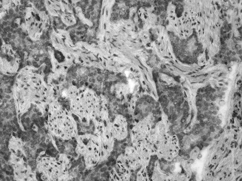 CIL:33681, Homo sapiens, endocrine-paracrine cell of prostate gland, basal cell of prostate epithelium, luminal cell of prostate epithelium, blood vessel endothelial cell, perineural cell, sheath cell, leukocyte, prostate stromal cell, smooth muscle cell of prostate