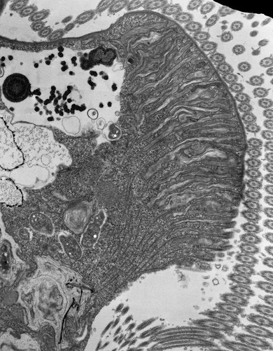 CIL:39114, Euplotes sp., cell by organism, eukaryotic cell, Eukaryotic Protist, Ciliated Protist