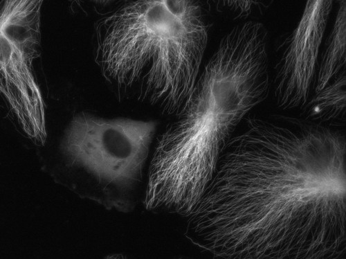 CIL:7437, Homo sapiens, endothelial cell, primary cell line cell