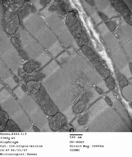 CIL:257, Mus musculus, skeletal muscle cell