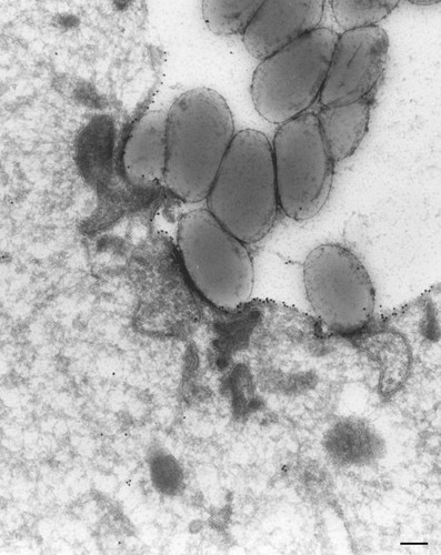 CIL:36741, Paramecium multimicronucleatum, cell by organism, eukaryotic cell, Eukaryotic Protist, Ciliated Protist