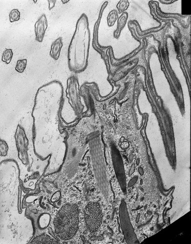 CIL:9018, Coleps hirtus, eukaryotic cell, Eukaryotic Protist, Ciliated Protist