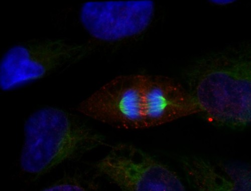 CIL:7245, Homo sapiens, epithelial cell