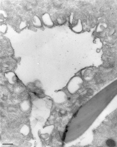 CIL:36720, Paramecium multimicronucleatum, cell by organism, eukaryotic cell, Eukaryotic Protist, Ciliated Protist