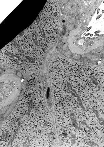 CIL:38865, Didinium nasutum, cell by organism, eukaryotic cell, Eukaryotic Protist, Ciliated Protist