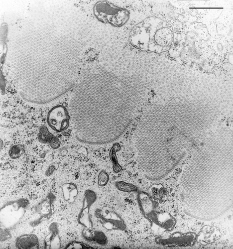 CIL:9839, Nassula, cell by organism, eukaryotic cell, Eukaryotic Protist, Ciliated Protist