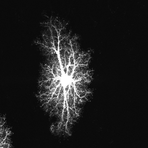 CIL:36352, Rattus norvegicus, astrocyte, astrocyte of the hippocampus