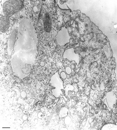 CIL:13138, Paramecium multimicronucleatum, cell by organism, eukaryotic cell, Eukaryotic Protist, Ciliated Protist