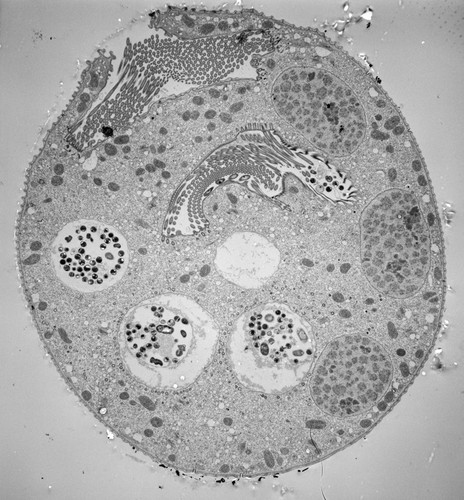 CIL:39403, Vorticella convallaria, cell by organism, eukaryotic cell, Eukaryotic Protist, Ciliated Protist