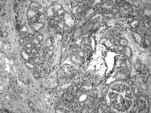 CIL:34074, Homo sapiens, endocrine-paracrine cell of prostate gland, basal cell of prostate epithelium, luminal cell of prostate epithelium, blood vessel endothelial cell, perineural cell, sheath cell, leukocyte, prostate stromal cell, smooth muscle cell of prostate