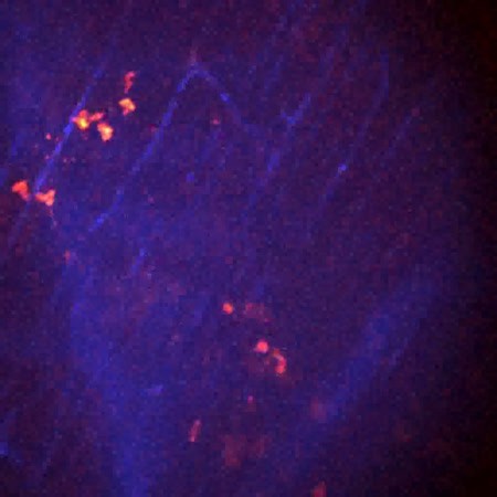 CIL:47657, Staphylococcus aureus, neutrophil, endothelial cell