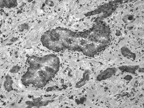 CIL:33671, Homo sapiens, endocrine-paracrine cell of prostate gland, basal cell of prostate epithelium, luminal cell of prostate epithelium, blood vessel endothelial cell, perineural cell, sheath cell, leukocyte, prostate stromal cell, smooth muscle cell of prostate