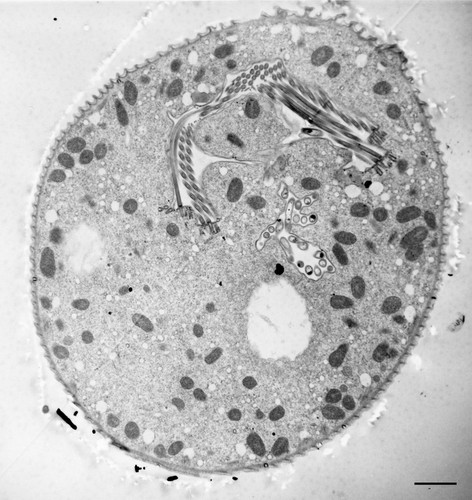 CIL:36255, Vorticella convallaria, cell by organism, eukaryotic cell, Eukaryotic Protist, Ciliated Protist