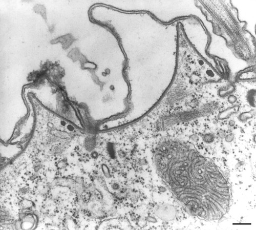 CIL:17447, Paramecium multimicronucleatum, cell by organism, eukaryotic cell, Eukaryotic Protist, Ciliated Protist