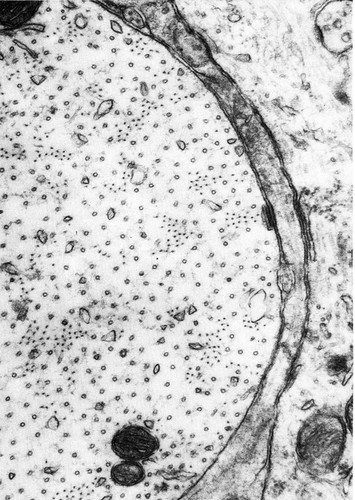 CIL:36044, Vertebrata, CNS neuron (sensu Vertebrata)