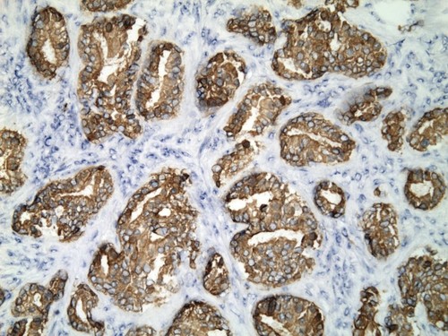 CIL:34222, Homo sapiens, endocrine-paracrine cell of prostate gland, basal cell of prostate epithelium, luminal cell of prostate epithelium, blood vessel endothelial cell, perineural cell, sheath cell, leukocyte, prostate stromal cell, smooth muscle cell of prostate