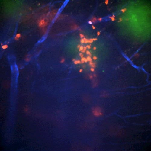 CIL:47389, Staphylococcus aureus, neutrophil, endothelial cell