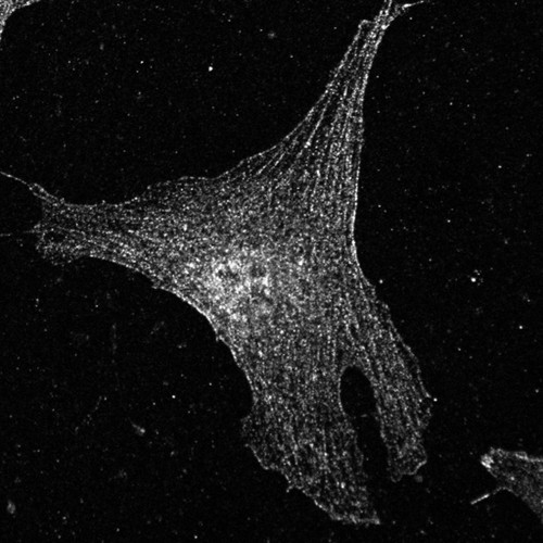 CIL:26527, Mus musculus, fibroblast