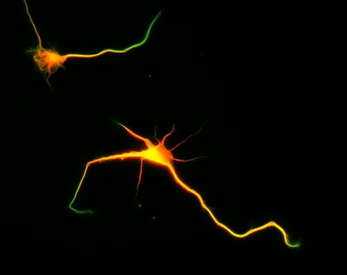 CIL:8469, Rattus, multipolar neuron