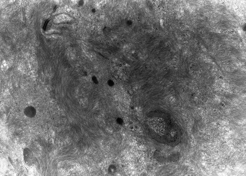 CIL:10055, Rana catesbeiana, barrier epithelial cell